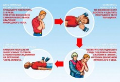 Что делать, если человек подавился
